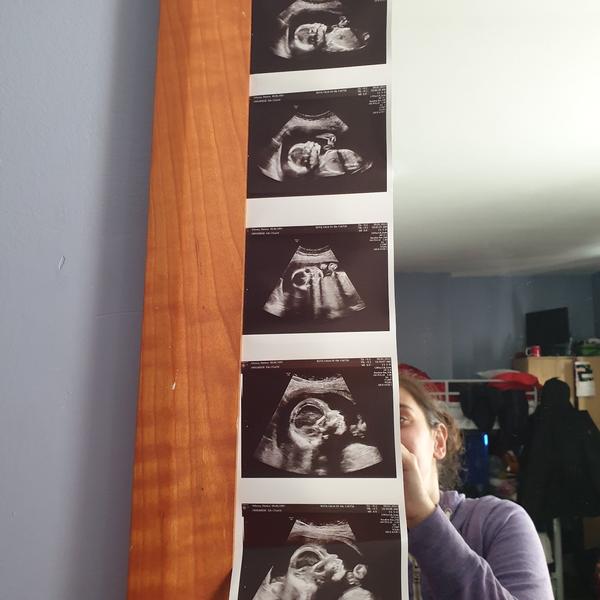 Holka nebo kluk: Jak poznat pohlaví miminka?