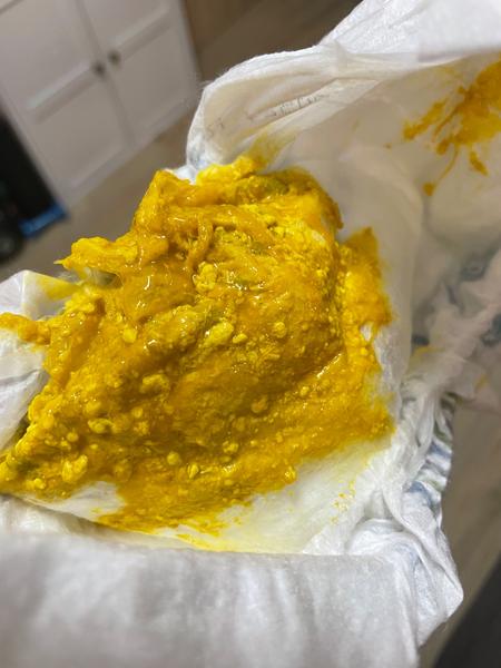 Stolice kojence. Je konzistence v normě?