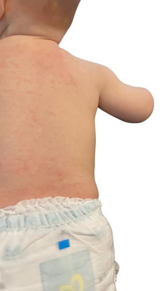 Muže to být šestá nemoc?