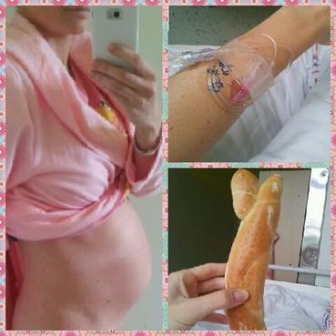 Hospitalizace v nemocnici - placenta praevia