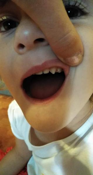 Něco se tlačí na zoubek. Co to je? Poradíte?