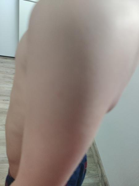 Pupínky u školkového dítěte. Co to může být?