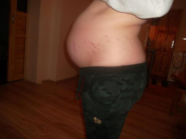 Břicho mi jde ve 32tt čím dál tím víc dolů, poraďte