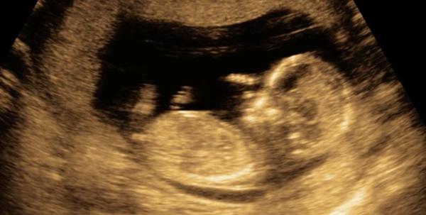 Holčička nebo chlapeček?