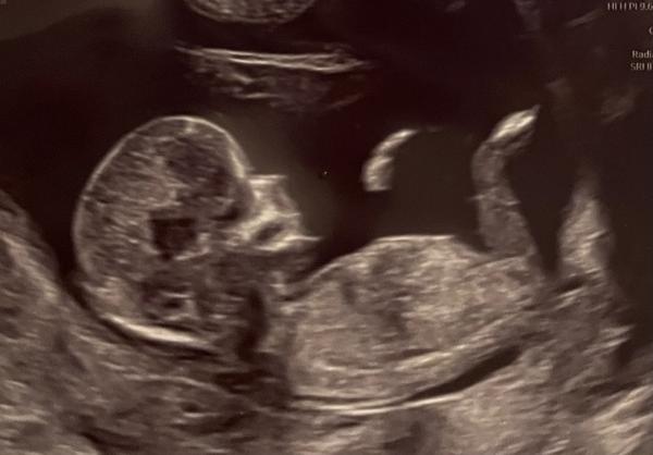 Pohlaví. Je možné určit z těchto fotek?