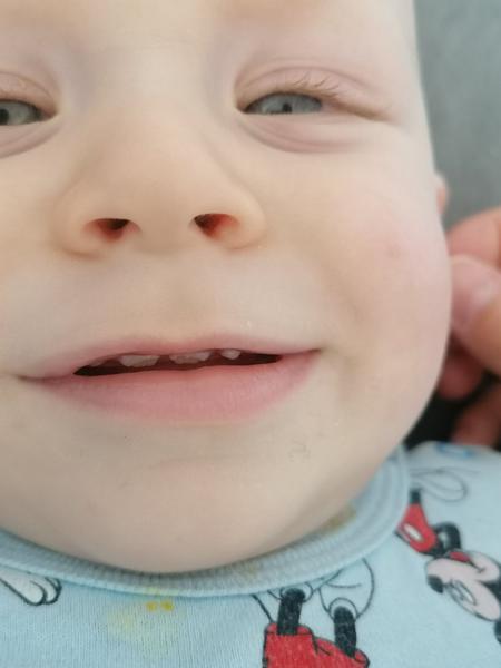 Zoubky. Co si myslíte o předních zubech, jedničkách?