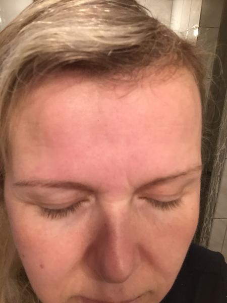 Fleky po celém těle. Co by to mohlo být?