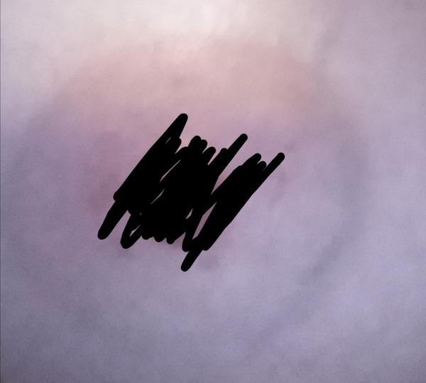 Fialová žíla na prsu. Pelášit nebo je to normální?