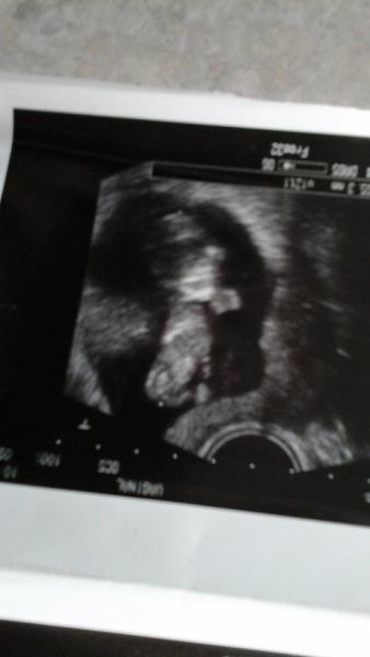 Odhalíte mi pohlaví miminka vy? Když dr. nechce