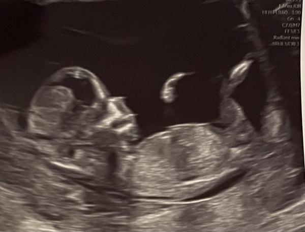 Pohlaví. Je možné určit z těchto fotek?