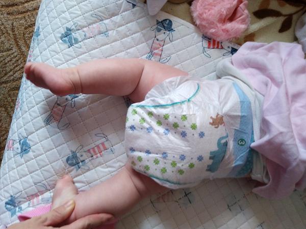 Rýha na nožičce - asymetrie z pohledu zezadu. Řešíte to?