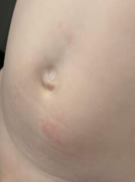 Pupínky u dítěte: Jak zjistit jejich původ?