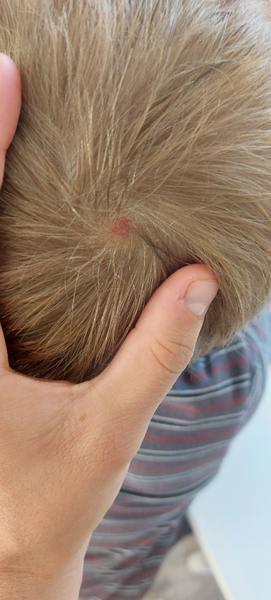 Co znamená červený flek na hlavě dítěte?