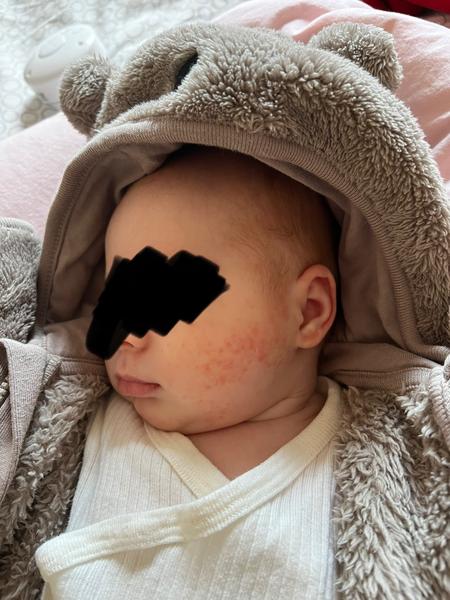 Mohlo by se jednat o seboreu?