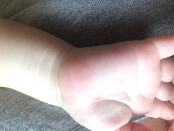 Syn má parainfekční virózu. Z čeho by to mohlo být?