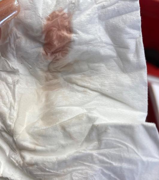 Narůžovělé špinění v těhotenství: Je to normální?