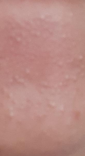 Pleť. Nevíte, co by to mohlo být?