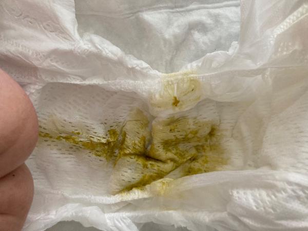 Průjem u 4měsíčního kojence. Může to být i růstem zoubků?