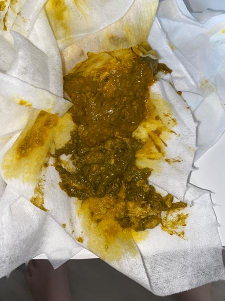 2měsíční miminko - problém s UM. Je takové vyprazdňování v pořádku?