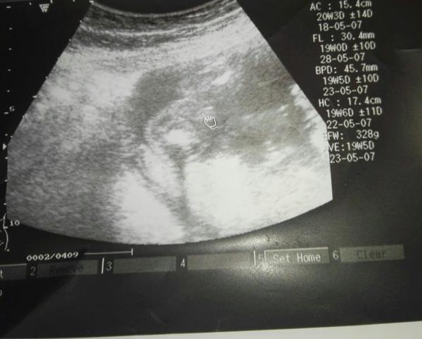 Chlapeček nebo holčička. Co si myslíte?