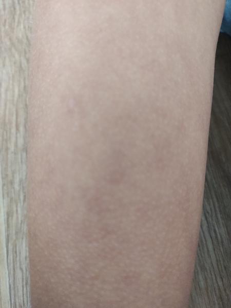 Je tohle normální stav kůže?