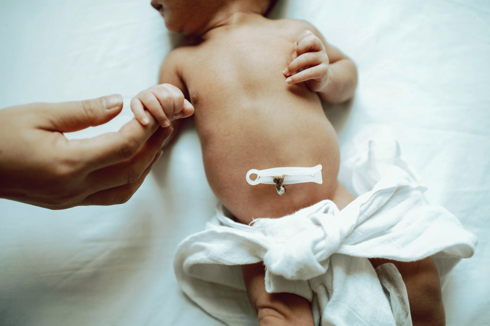 Marginální úpon pupečníku