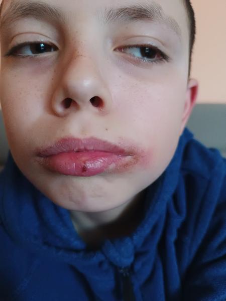 Prosím poraďte co to je a čím namazat