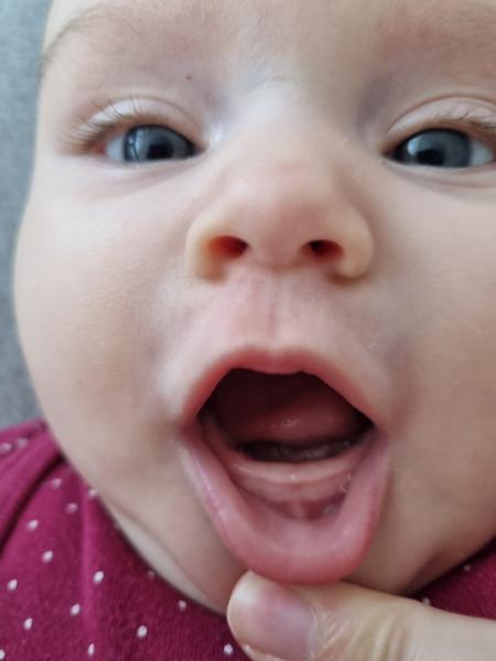 Jak poznat růst zoubků u tříměsíční dcery?