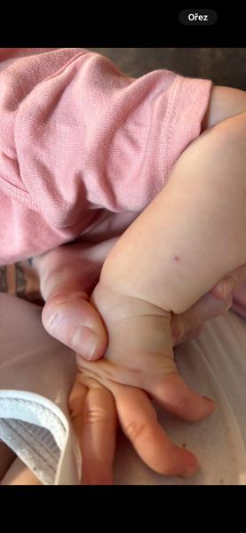 Je zvláštní znaménko na ruce dcery důvodem k obavám?