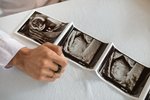 6. tt a srdeční akce. Kdy jste poprvé viděly na ultrazvuku?