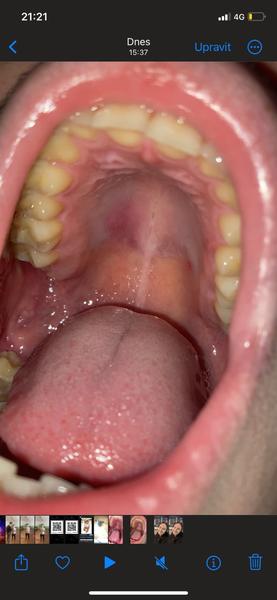 Co by to mohlo být?