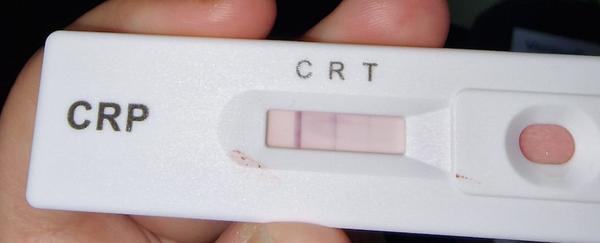 Zkušenosti s domácím testem CRP Veroval u dětí?