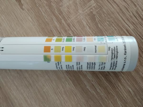 Jak rozpoznat zánět močového měchýře testováním moči?