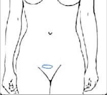 Objevení tvrdšího útvaru v podbřišku: Co znamená?