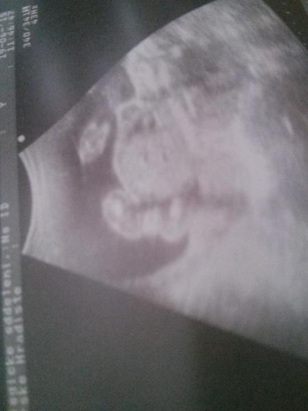 Taky vidíte holčičku?