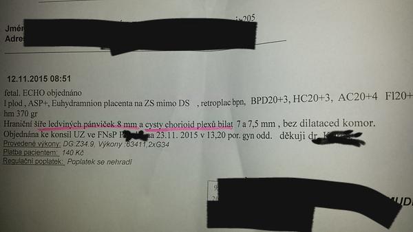 Zvětšené ledvinové pánvičky a cysty choroid plexu