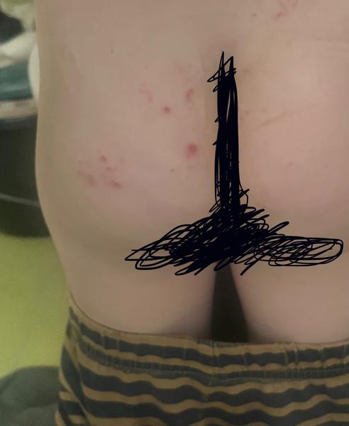 Jak řešit vyrážku u dítěte?