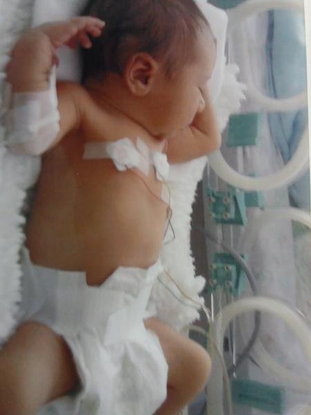 Vitiligo u 6leté, máte někdo? Jak jste to řešili?