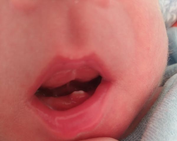 Zub při narození. Setkaly jste se s tím?