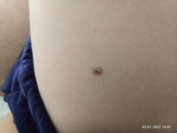 Piha u čtyřletého dítěte: Máte podobnou zkušenost?