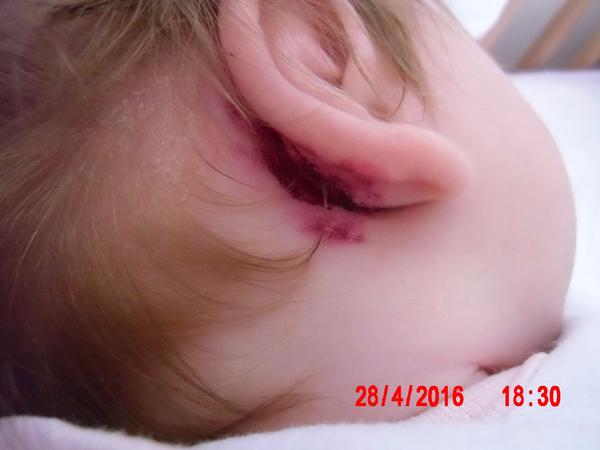 2měsíční dcera má "něco" za ouškem