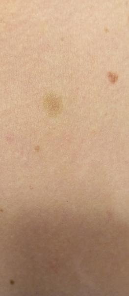 Piha. Proč je takto ohraničená?