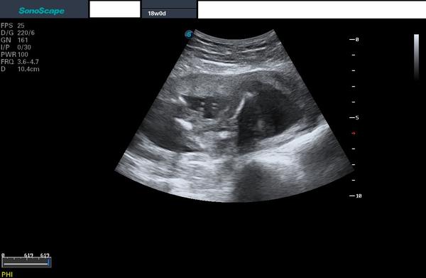 Co je na ultrazvukovém snímku? 😃