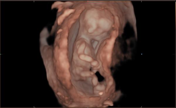 Pozná někdo pohlaví podle hrbolku z fotky?