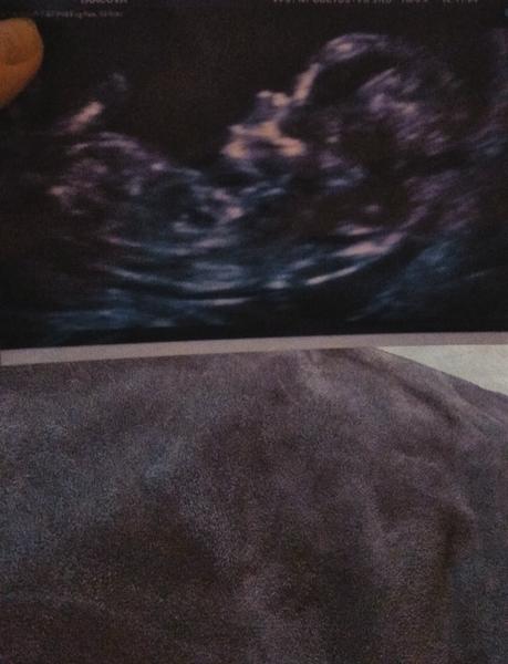 Určení pohlaví - poznáte to někdo?