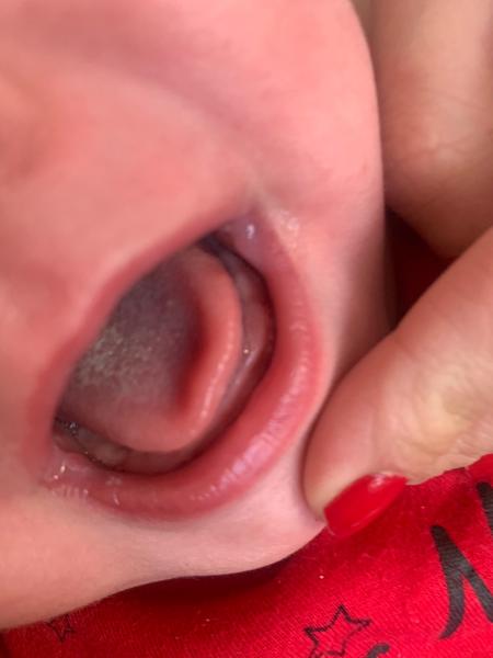 Rostou dítěti zuby? Zjistěte, jak to poznat.