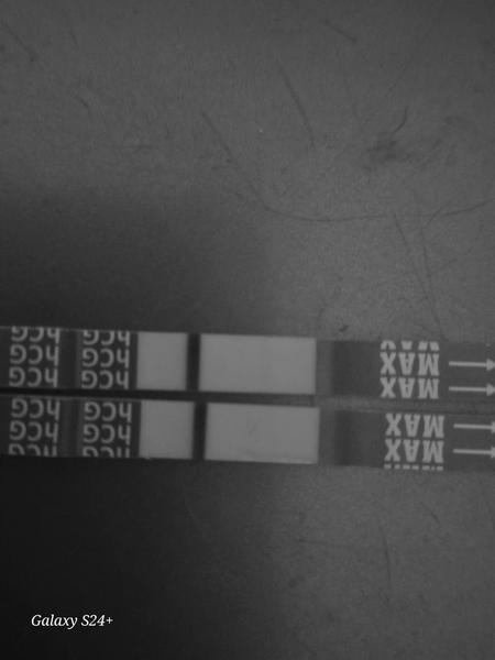 Otěhotnění po sterilizaci. Máte zkušenost?