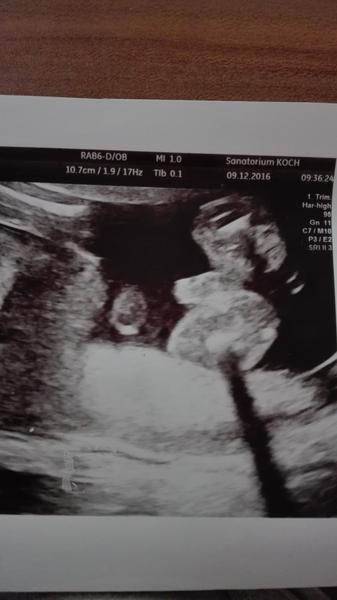 Kluk nebo holčička?