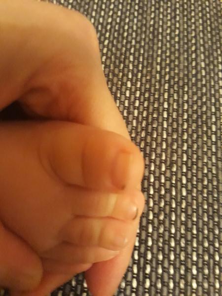 Černý nehet. Čím by to mohlo být?