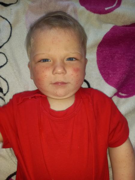 Potničky nebo nějaká alergie?